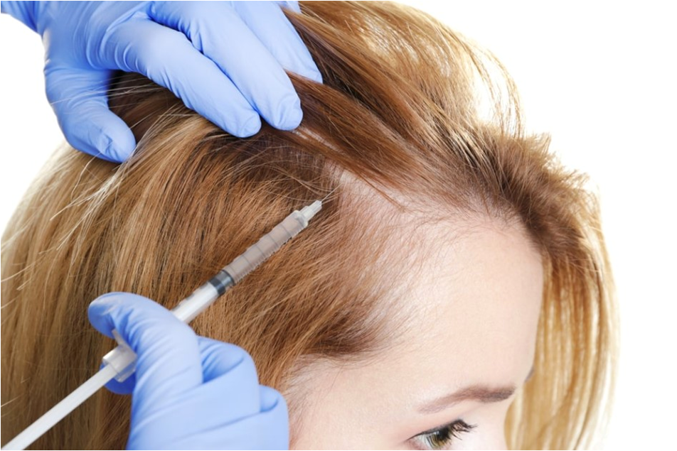 Non Surgical Hair Treatment for PRP